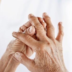 Manos de persona mayor que sufre de artrosis